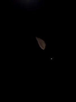 Anxiety420 online show from March 2, 4:34 am